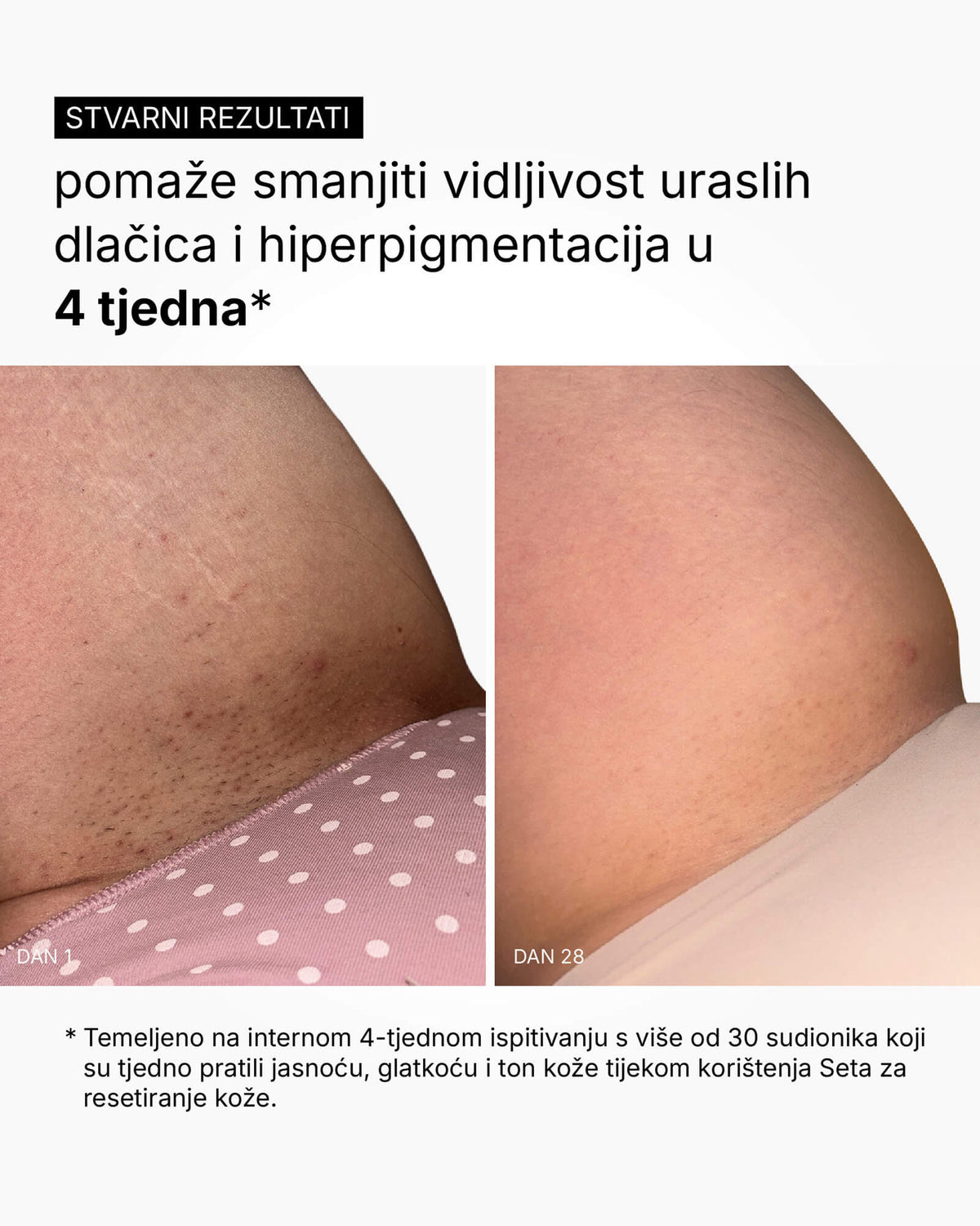 Sada Skin Reset – Kompletní tělová rutina