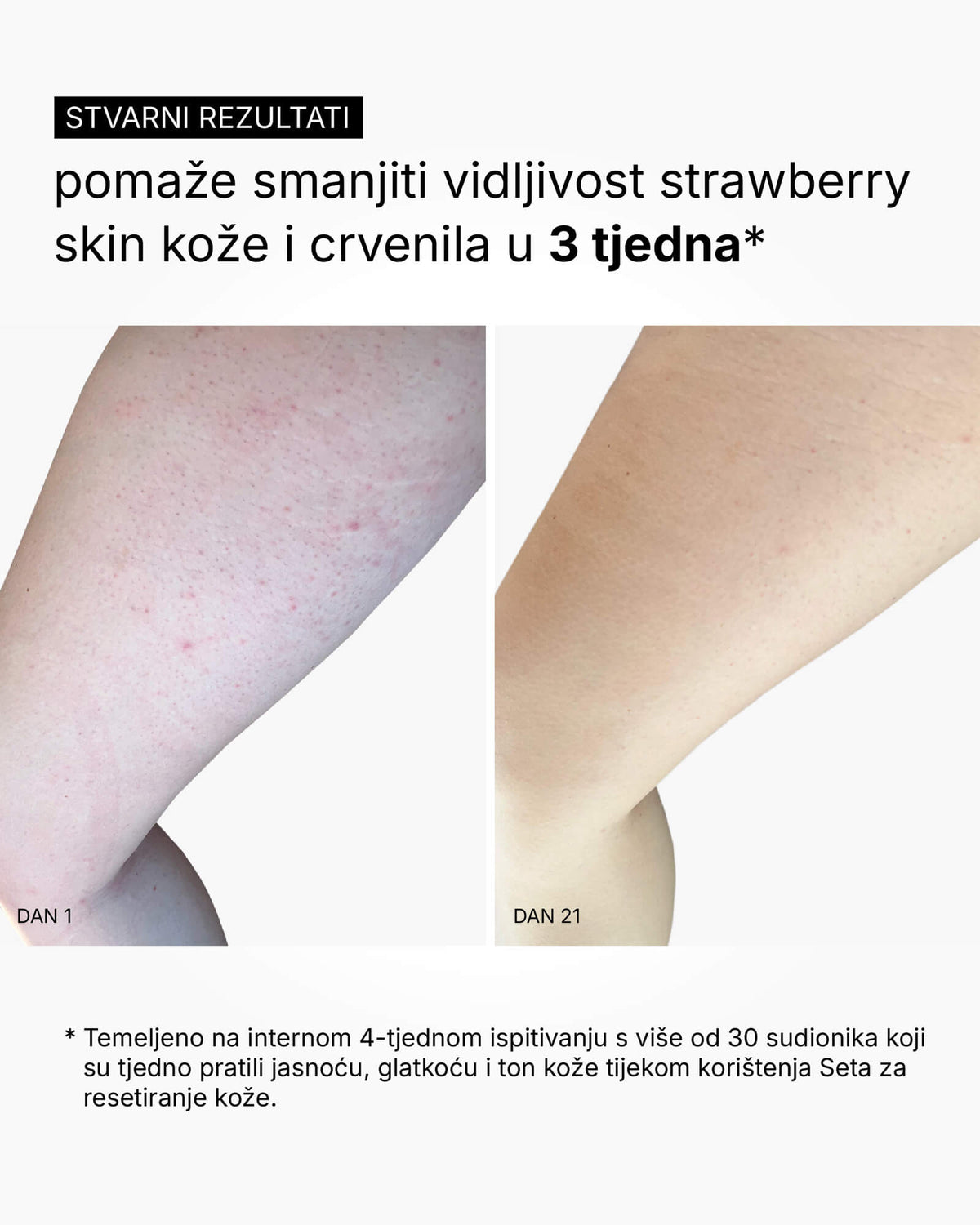 Sada Skin Reset – Kompletní tělová rutina